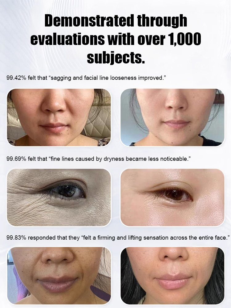  Collagen Fill & Repair Cream✨99.69% of participants noticed reduced fine lines and wrinkles, and 99.83% experienced overall facial firming and lifting