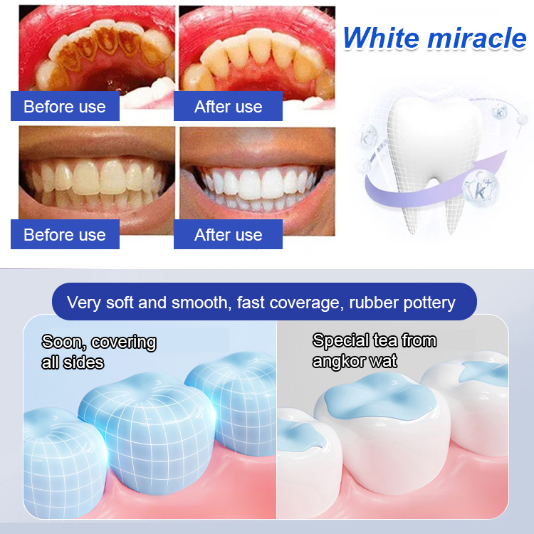 7.5% Nano-Hydroxyapatite Restorative Toothpaste