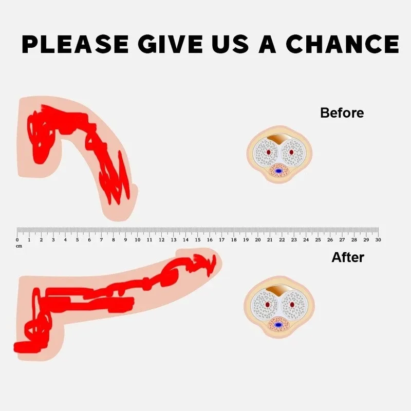 💖All-Natural Formulation🔥man's secret weapon(God Of War Seven Times A Night）-suzhom