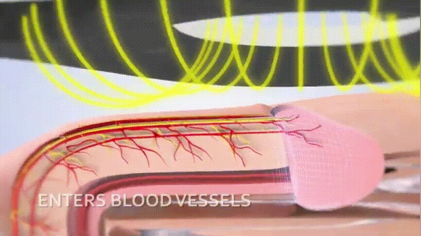 Blood Circulation