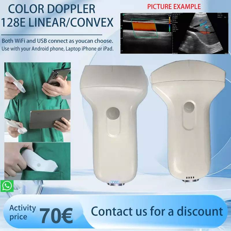 XP-2 - Sistema ecografico portatile