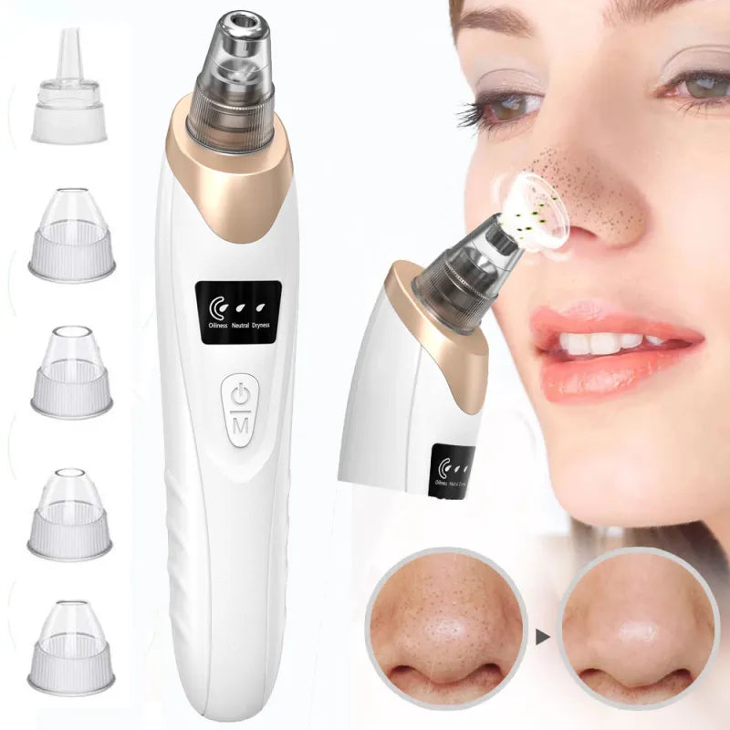 🔥⏰Limited Time Offer 49% OFF🔥-Electric Blackhead Remover