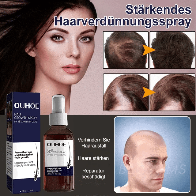 🔥Hot sale 49%OFF🔥Natural Hair Regrowth Spray