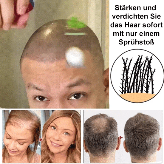 🔥Hot sale 49%OFF🔥Natural Hair Regrowth Spray