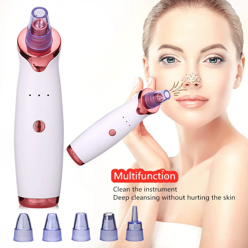 🔥⏰Limited Time Offer 49% OFF🔥-Electric Blackhead Remover