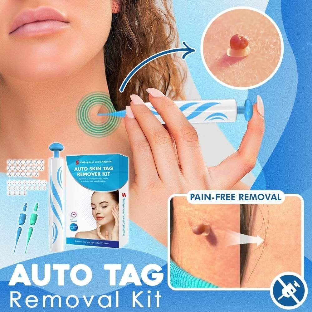 💖Hot Sale 49% OFF💥Auto Tag Fast Removal Kit