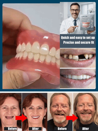 Comfortable denture set that supports facial structure-Wear for life, no replacement needed!