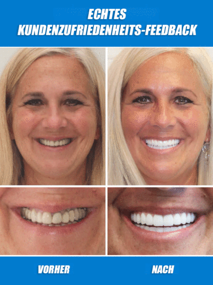 【FDA & CE-zertifizierter Realistischer Zahnersatz】Lebenslang tragbar – kein Austausch nötig!