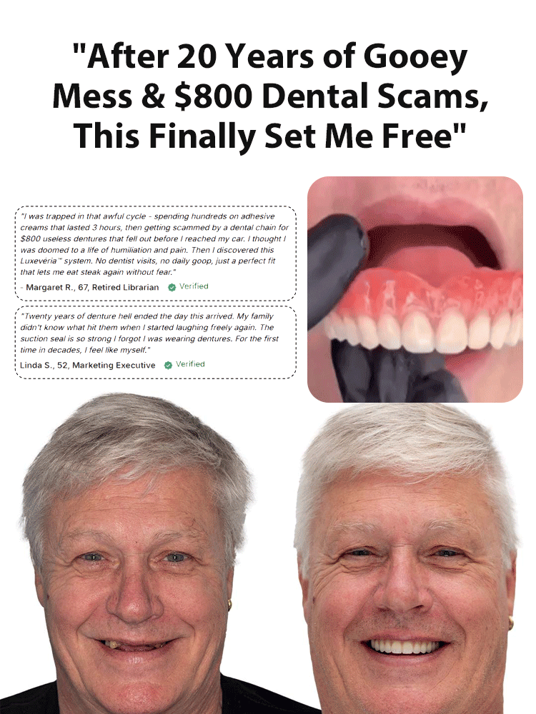[FDA Certified] Full-mouth bone-supported denture set-Over 300,000 users worldwide