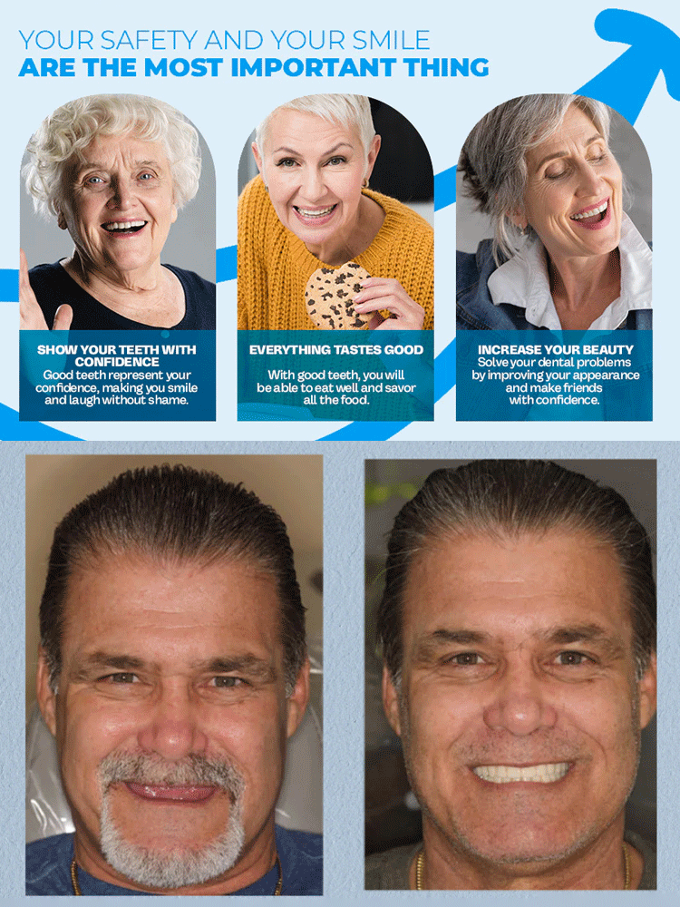 【FDA Certified & Million Positive Reviews】Full Mouth Suction Dentures
