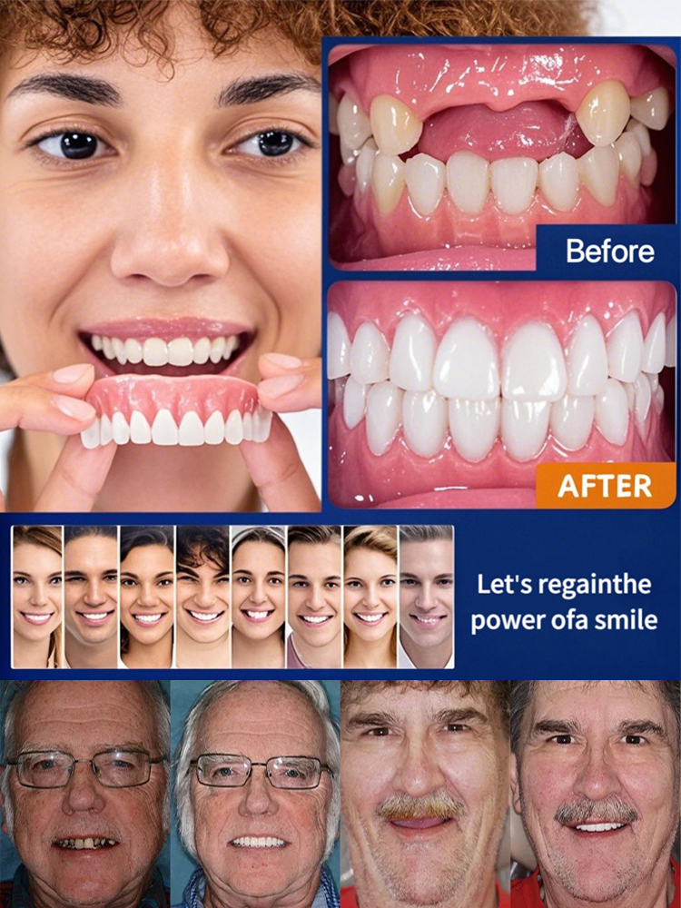 【FDA Certified & Million Positive Reviews】Full Mouth Suction Dentures