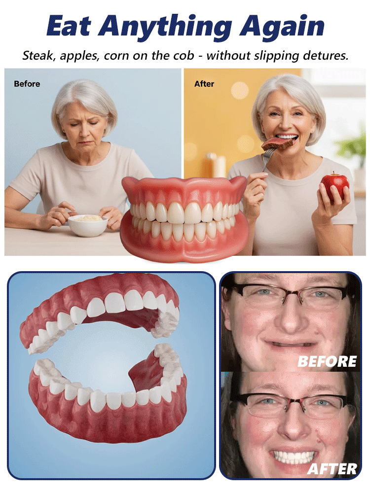 【FDA & BDA Dual-Certified Realistic Denture Set】Wear for Life, No Replacement Needed!