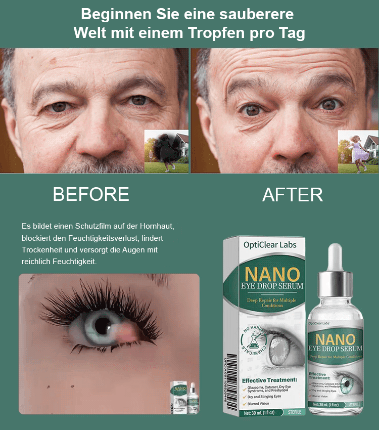 🌟 Verabschieden Sie sich vom Grauen Star – Willkommen zum klaren Durchblick! 🌟