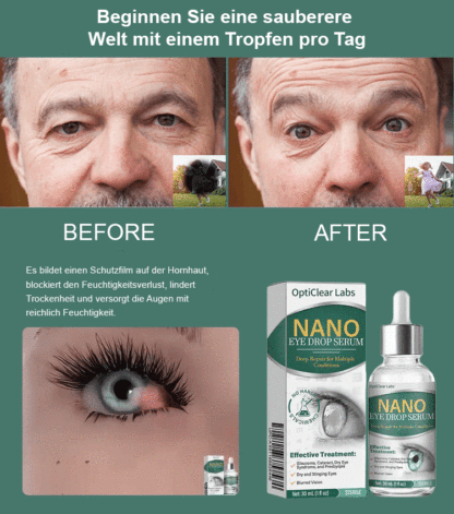 🌟 Verabschieden Sie sich vom Grauen Star – Willkommen zum klaren Durchblick! 🌟
