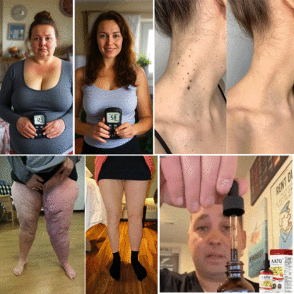 [Einfache Blutzuckerkontrolle] Hypoglykämie-Tropfen