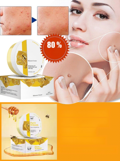 DermaVital Precision Creme