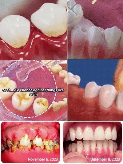 Hai-Knorpel-Protein Zahnregenerations-Tropfen | Medizinisches Pflegelevel