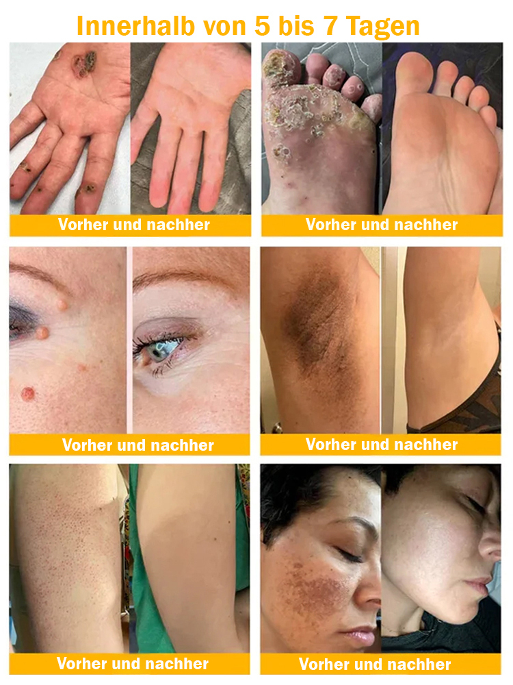 DermaVital Precision Creme