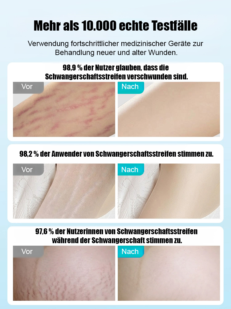 24-Stunden-Silikon-Gel-Narbenpflaster zur kontinuierlichen Narbenpflege