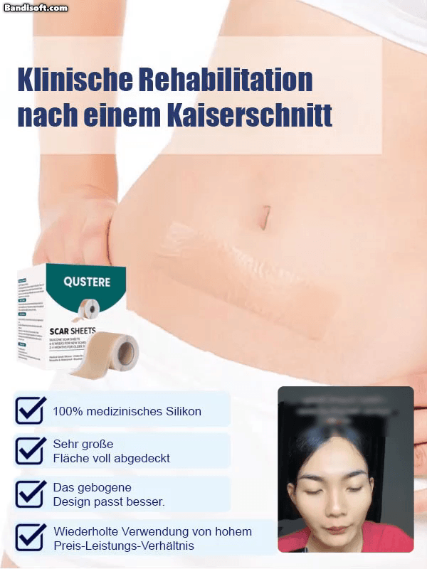 24-Stunden-Silikon-Gel-Narbenpflaster zur kontinuierlichen Narbenpflege