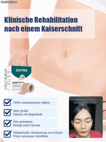 24-Stunden-Silikon-Gel-Narbenpflaster zur kontinuierlichen Narbenpflege