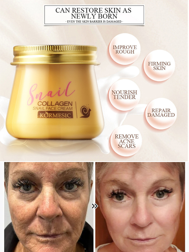 [Secret to Youthful Skin] Snail Hydrating, Anti-Wrinkle and Rejuvenating Cream