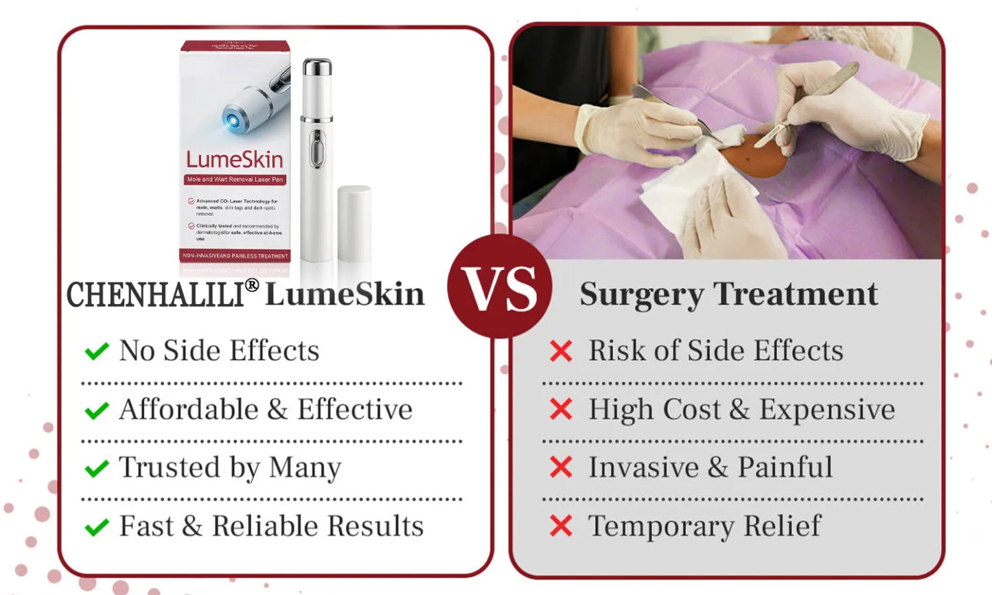 ❤CHENHALILI® LumeSkin Mole and Wart Removal Laser Pen ❤️