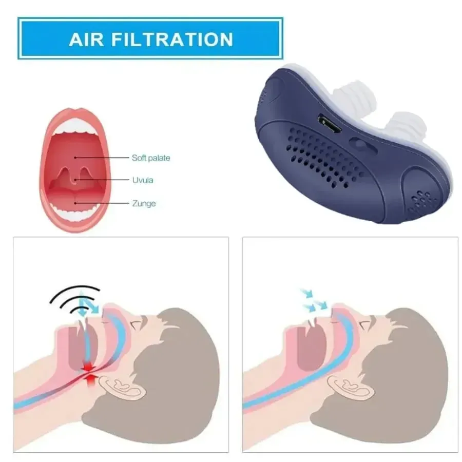 🔥🔥LAST DAY PROMOTION 49% OFF🔥 HOSELESS, MASKLESS, MICRO-CPAP ANTI SNORING