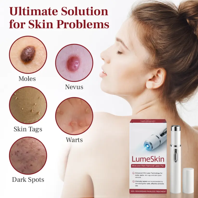 ❤CHENHALILI® LumeSkin Mole and Wart Removal Laser Pen ❤️