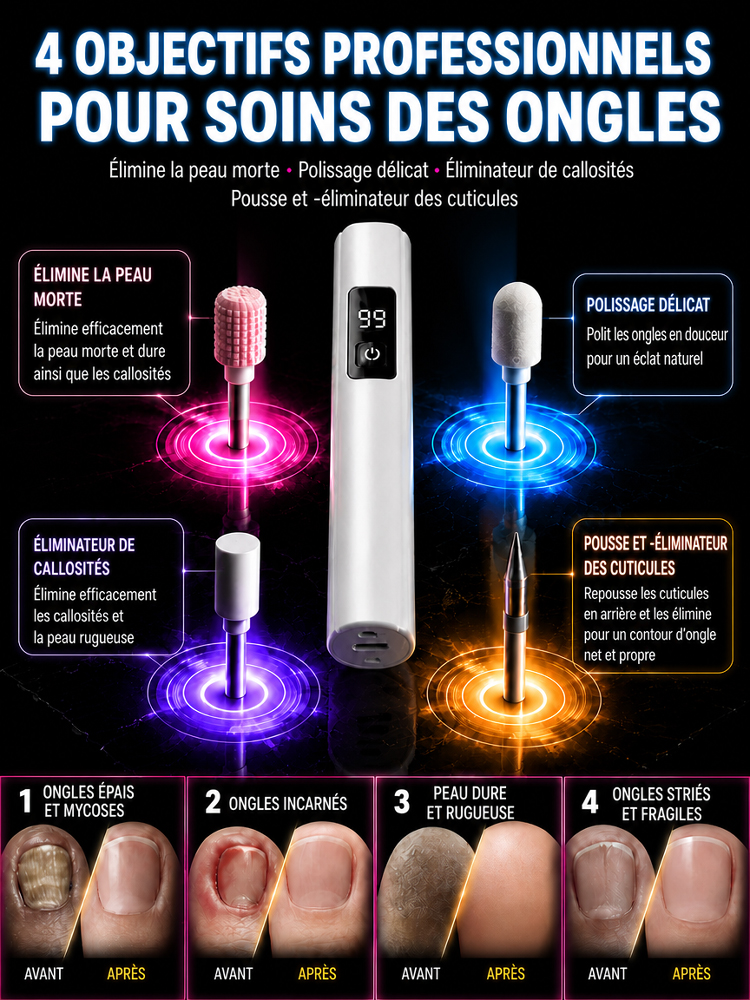 [Dites adieu aux mycoses des ongles et obtenez des ongles parfaits rapidement] Polisseuse à ongles électrique