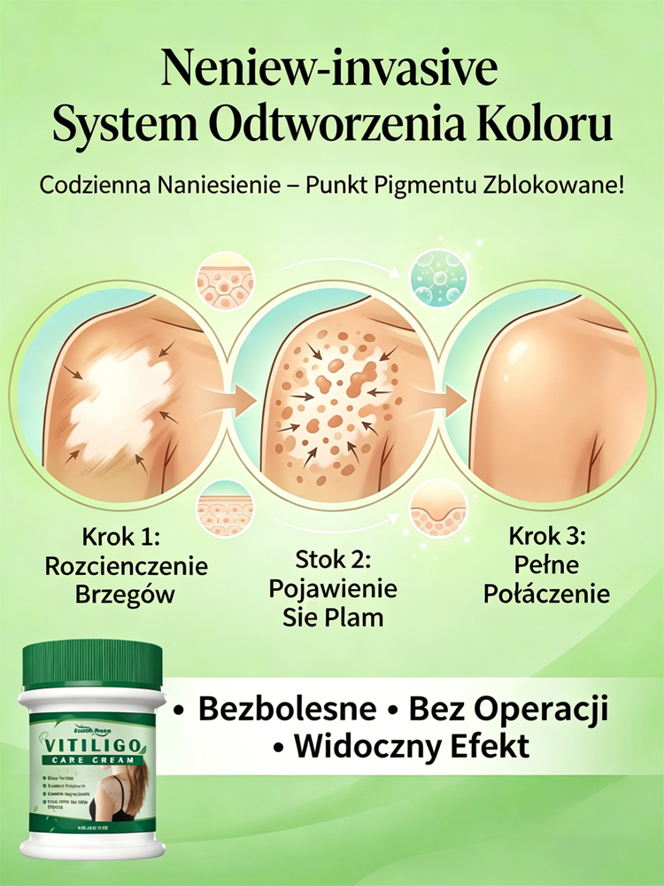 Bezhormonalny krem do pielęgnacji białych plam, szybkie działanie
