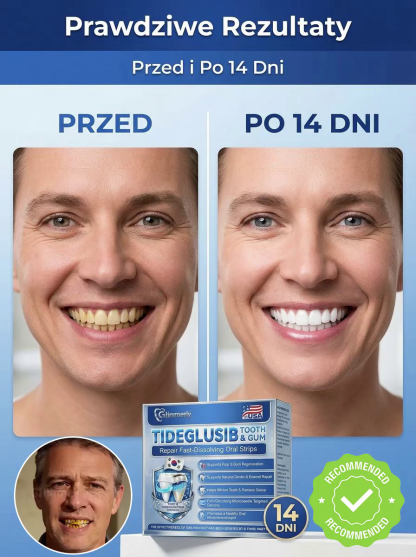 ⚡ Ulga w 30 sekund! Szybkorozpuszczalne plastry na silny ból zębów i krwawiące dziąsła 🦷