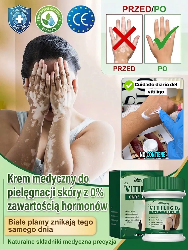 Bezhormonalny krem do pielęgnacji białych plam, szybkie działanie