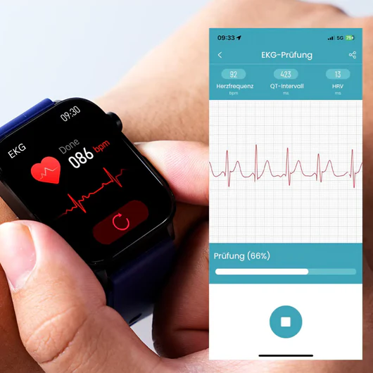 MYWATCH – AZ OKOSÓRA, AMI A SZÍVEDHEZ SZÓL