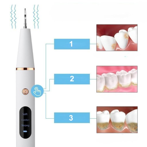 ULTRAHANGOS FOGÁSZATI MÉRLEG ERŐS VÍZKŐ ELTÁVOLÍTÁS