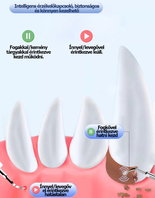 Fogkő eltávolító kutyáknak, ultrahangos fogtisztító háziállatoknak, macskafog-tisztító eszköz, mini fogtisztító.