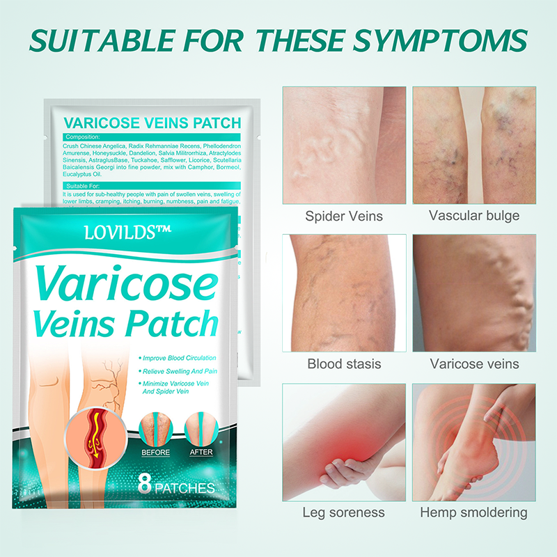 ✨ Lovilds™ Leech Varicose Vein Patch - 85% off! 🌸Clinically proven to quickly reduce varicose veins!