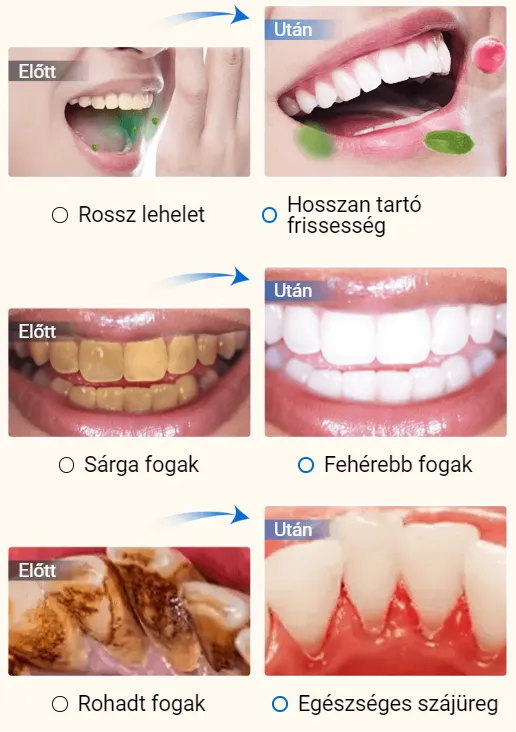 🔥1+1 ajándék🔥Niacinamid 7 napos fehérítő fogkrém