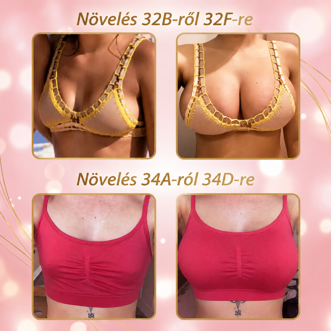 [Copy]ÉCLANCIER® 3 az 1-ben nanotűs tapaszok | Mellnagyobbítás • Fenékemelés • Feszesítő támogatás