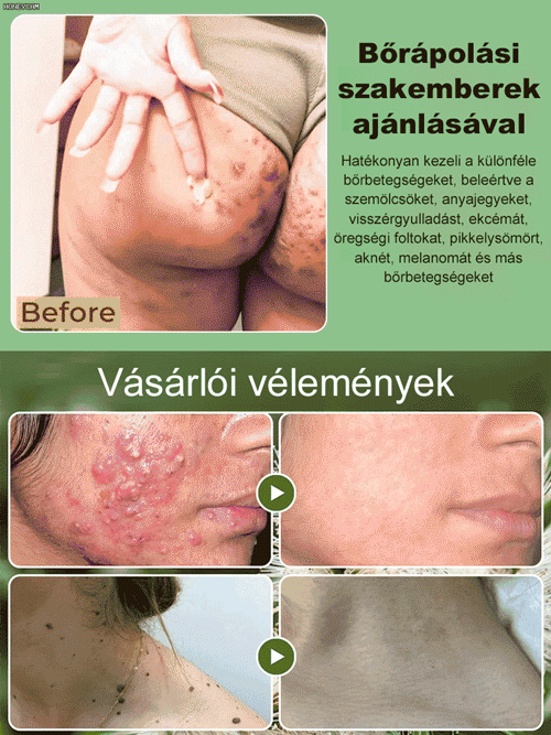 Tea fa olaj bőr javítási krém