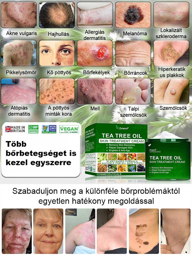 Tea fa olaj bőr javítási krém