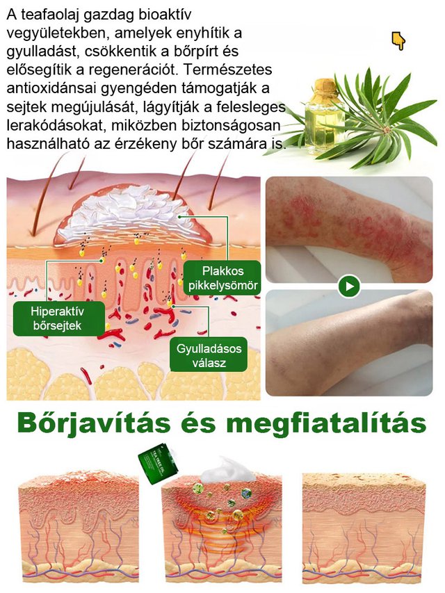Tea fa olaj bőr javítási krém