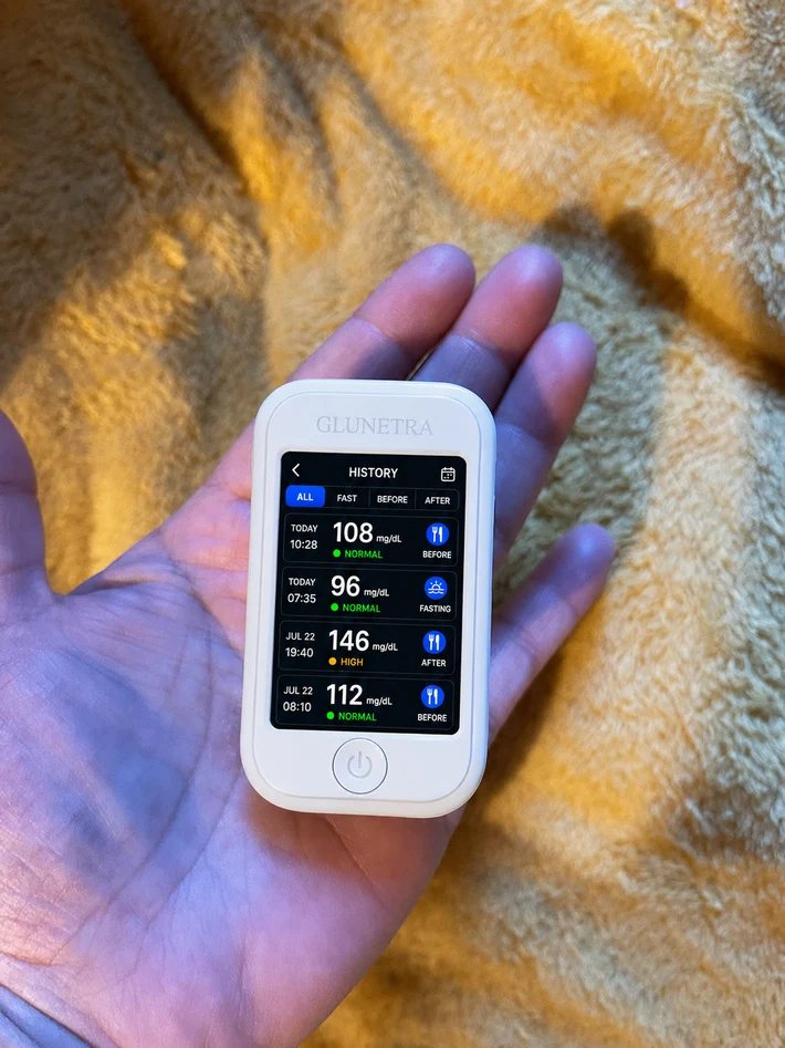 GLUNETRA G5 term&eacute;kfot&oacute;
