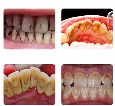 ULTRAHANGOS FOG&Aacute;SZATI M&Eacute;RLEG ERŐS V&Iacute;ZKŐ ELT&Aacute;VOL&Iacute;T&Aacute;S Fajta nincs meghat&aacute;rozva