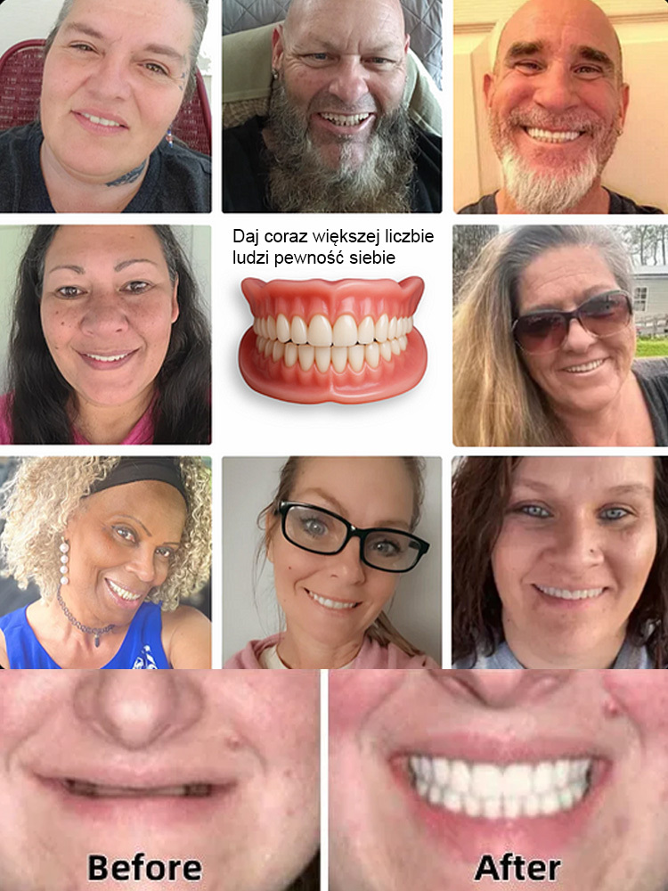 😁Wygodne, niewidoczne protezy zębowe｜3-sekundowe dopasowanie・Spersonalizowane dopasowanie🦷