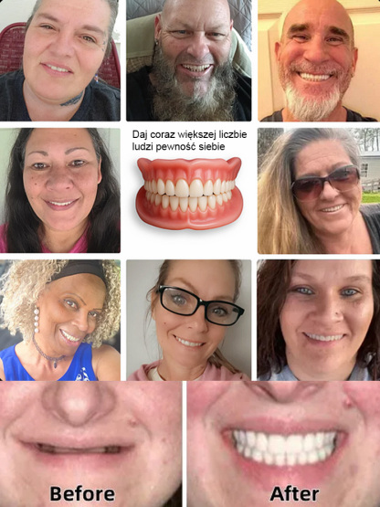 😁Wygodne, niewidoczne protezy zębowe｜3-sekundowe dopasowanie・Spersonalizowane dopasowanie🦷