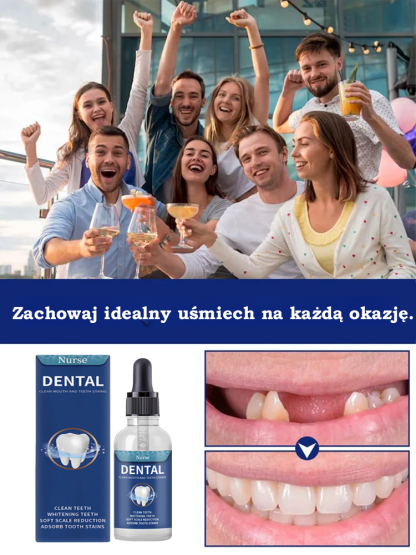 【🔥Kup jeden, drugi gratis】🦈Technologia regeneracji zębów rekina w kolorze czarnym! Z łatwością naprawia ubytki✅