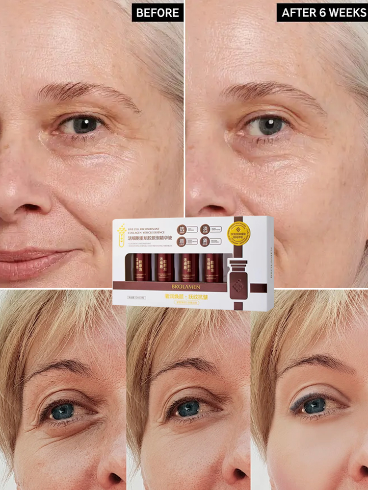 💥Wrinkle Eraser🧴 Esencja kolagenowa Cell Recombination, precyzyjnie redukuje drobne linie, jednocześnie nawilżając i ujędrniając🌟