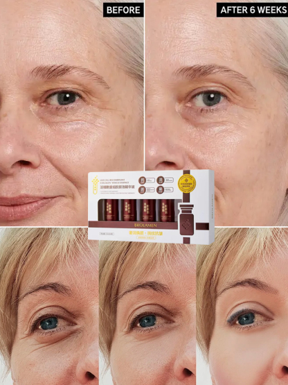 💥Wrinkle Eraser🧴 Esencja kolagenowa Cell Recombination, precyzyjnie redukuje drobne linie, jednocześnie nawilżając i ujędrniając🌟