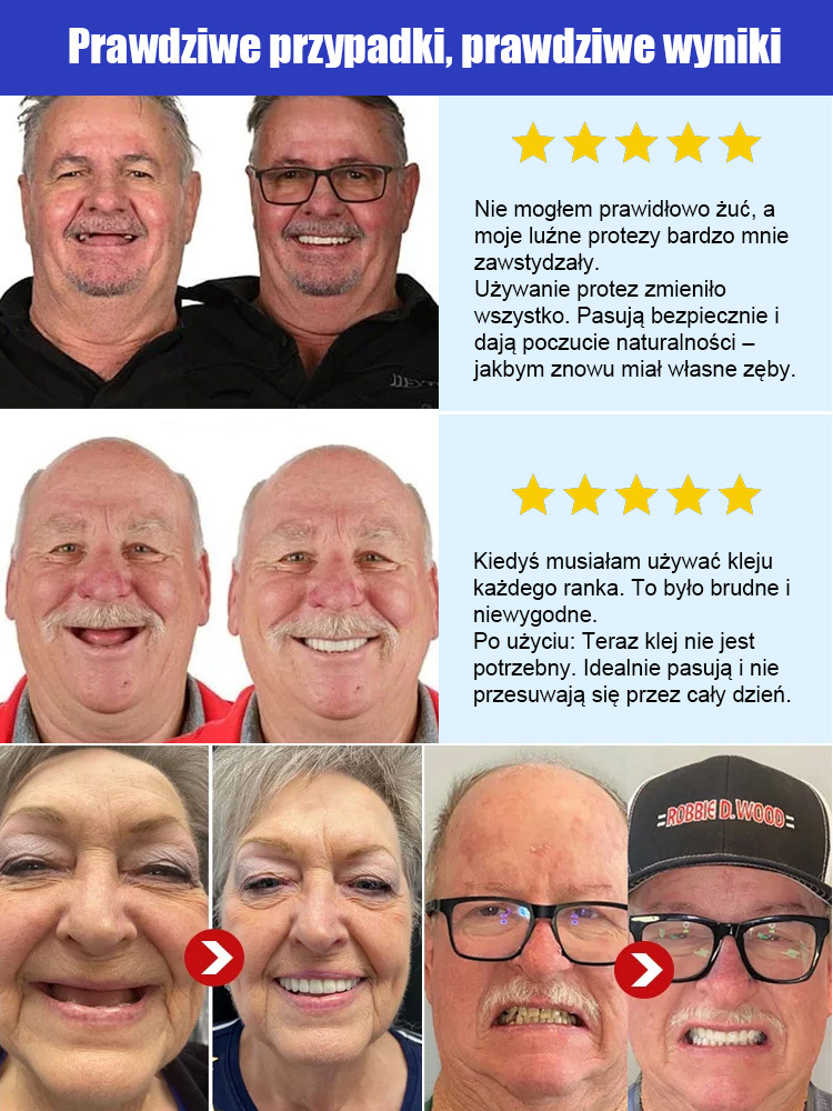 😁Wygodne, niewidoczne protezy zębowe｜3-sekundowe dopasowanie・Spersonalizowane dopasowanie🦷